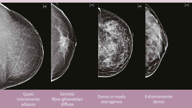 Abus-densita-seno